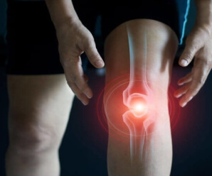 ArthroMD+ for joint strain support